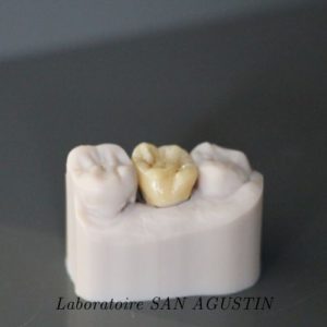 Couronnes zircone multicouches Laboratoire San Agustin