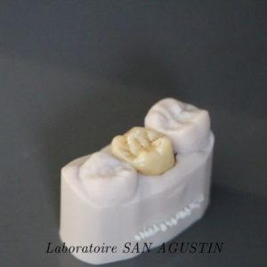 Couronnes zircone multicouches Laboratoire San Agustin